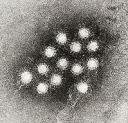 hepatitis_a_virus_.jpg